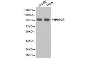 Western Blotting (WB) image for anti-3-Hydroxy-3-Methylglutaryl-CoA Reductase (HMGCR) antibody (ABIN1873048) (HMGCR Antikörper)