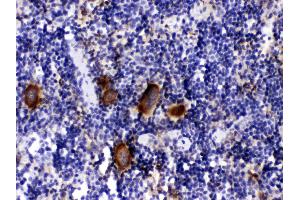 PF4 was detected in paraffin-embedded sections of mouse spleen tissues using rabbit anti- PF4 Antigen Affinity purified polyclonal antibody (Catalog # ) at 1 µg/mL.