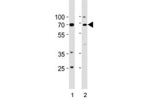 Western Blotting (WB) image for anti-Tumor Protein P73 (TP73) (AA 288-317) antibody (ABIN3029400)