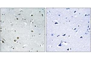 Immunohistochemistry (IHC) image for anti-DEAD (Asp-Glu-Ala-Asp) Box Polypeptide 24 (DDX24) (AA 41-90) antibody (ABIN2890149) (DDX24 Antikörper  (AA 41-90))