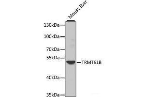 Western blot analysis of extracts of Mouse liver using TRMT61B Polyclonal Antibody at dilution of 1:1000. (TRMT61B Antikörper)