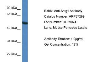 Western Blotting (WB) image for anti-Syntrophin, gamma 1 (SNTG1) (N-Term) antibody (ABIN2787161) (Syntrophin gamma 1 Antikörper  (N-Term))