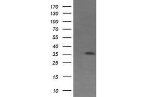 Western Blotting (WB) image for anti-T-cell surface glycoprotein CD1c (CD1C) antibody (ABIN1497192) (CD1c Antikörper)