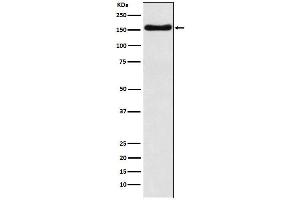 Western blot analysis of ATP7b expression in HepG2 cell lysate.