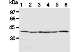 Western Blotting (WB) image for anti-HtrA Serine Peptidase 2 (HTRA2) antibody (ABIN1107619) (HTRA2 Antikörper)
