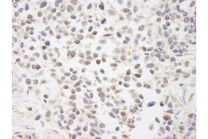 Immunohistochemistry (IHC) image for anti-Chromosome 7 Open Reading Frame 27 (C7orf27) (C-Term) antibody (ABIN7448427) (BAAT1 Antikörper  (C-Term))