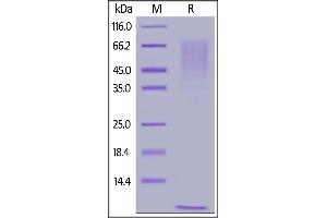 SDS-PAGE (SDS) image for Mucin 1 (MUC1) (AA 890-1158) protein (His tag) (ABIN6950993)