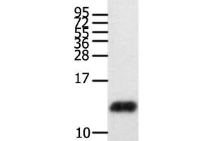 Western Blot analysis of Human brain glioma tissue using CCL28 Polyclonal Antibody at dilution of 1:450 (CCL28 Antikörper)