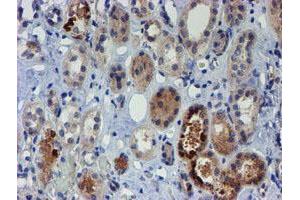 Immunohistochemical staining of paraffin-embedded Human Kidney tissue using anti-PGM3 mouse monoclonal antibody. (Phosphoglucomutase 3 Antikörper)