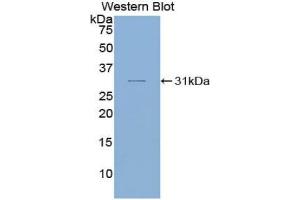 Western blot analysis of the recombinant protein. (SMAD6 Antikörper  (AA 116-364))