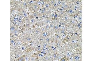 Immunohistochemistry of paraffin-embedded Human liver using GLA Polyclonal Antibody at dilution of 1:100 (40x lens). (GLA Antikörper)