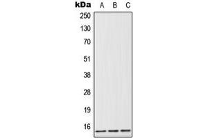 Western blot analysis of FABP1 expression in HeLa (A), Jurkat (B), rat liver (C) whole cell lysates. (FABP1 Antikörper  (Center))