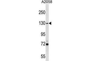 USP7 Antibody (Center) western blot analysis in A2058 cell line lysates (35 µg/lane). (USP7 Antikörper  (Middle Region))