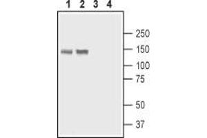 Western blot analysis of rat stomach lysate (lanes 1 and 3) and rat lung membranes (lanes 2 and 4): - 1,2. (ATP2B4 Antikörper  (2nd Cytoplasmic Loop))