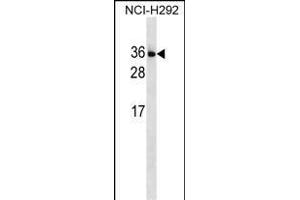 IL34 Antibody (N-term) (ABIN1539235 and ABIN2849950) western blot analysis in NCI- cell line lysates (35 μg/lane). (IL-34 Antikörper  (N-Term))