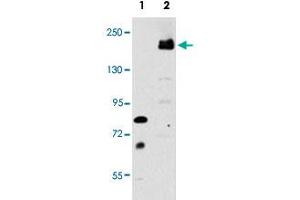 Western blot analysis of LRP6 (arrow) using rabbit LRP6 polyclonal antibody . (LRP6 Antikörper  (C-Term))