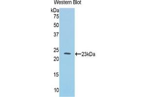 Western blot analysis of the recombinant protein. (IL1RL1 Antikörper  (AA 357-532))