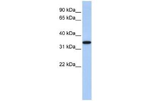 ART4 antibody used at 1 ug/ml to detect target protein. (ART4 Antikörper)