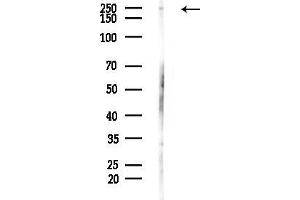 anti-Mediator Complex Subunit 12 (MED12) (Internal Region) antibody