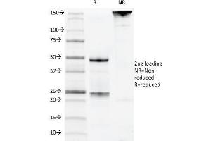 SDS-PAGE Analysis Purified CD22 Mouse Monoclonal Antibody (MYG13). (CD22 Antikörper)