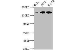 Western Blot Positive WB detected in: Hela whole cell lysate, 293T whole cell lysate, HepG2 whole cell lysate All lanes: LRPPRC antibody at 4 μg/mL Secondary Goat polyclonal to rabbit IgG at 1/50000 dilution Predicted band size: 158 kDa Observed band size: 158 kDa (LRPPRC Antikörper  (AA 901-1036))