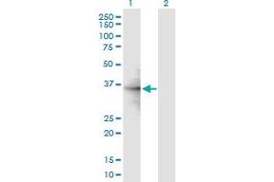 Western Blot analysis of RPL6 expression in transfected 293T cell line by RPL6 MaxPab polyclonal antibody. (RPL6 Antikörper  (AA 1-288))