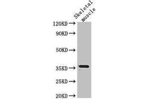 Western Blot Positive WB detected in: Mouse skeletal muscle tissue All lanes: EPM2A antibody at 3 μg/mL Secondary Goat polyclonal to rabbit IgG at 1/50000 dilution Predicted band size: 36, 38, 16, 25, 10, 21, 23 kDa Observed band size: 36 kDa (EPM2A Antikörper  (Isoform 9))