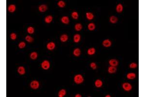 Immunofluorescence (fixed cells) (IF/ICC) image for anti-Regulator of Chromosome Condensation (RCC1) and BTB (POZ) Domain Containing Protein 1 (RCBTB1) (Internal Region) antibody (ABIN6264678)