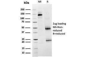 SDS-PAGE Analysis Purified TIM3 Mouse Monoclonal Antibody (TIM3/3113). (TIM3 Antikörper  (AA 22-202))