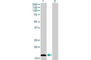 Western Blot analysis of NME3 expression in transfected 293T cell line by NME3 monoclonal antibody (M13), clone 3G10.