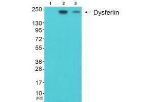 Western blot analysis of extracts from JK cells (Lane 2) and K562 cells (Lane 3), using Dysferlin antiobdy. (Dysferlin Antikörper)