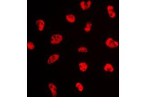 Immunofluorescent analysis of NFYA staining in K562 cells.