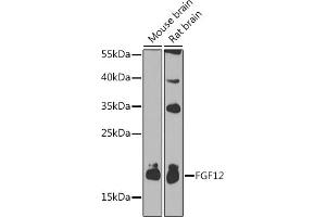Western blot analysis of extracts of various cell lines, using FGF12 antibody (ABIN3016419, ABIN3016420, ABIN1679841 and ABIN6219744) at 1:1000 dilution. (FGF12 Antikörper  (AA 1-181))