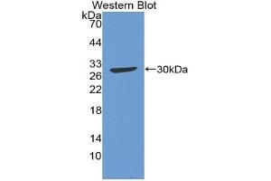 Detection of Recombinant C4, Gallus using Polyclonal Antibody to Complement Component 4 (C4) (Complement C4 Antikörper  (AA 1428-1660))