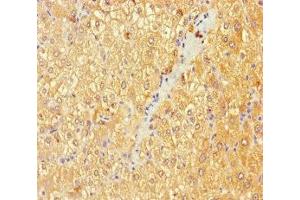 Immunohistochemistry (IHC) image for anti-UDP-Gal:betaGlcNAc beta 1,4- Galactosyltransferase, Polypeptide 3 (B4GALT3) (AA 34-393) antibody (ABIN7145392)