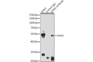 Immunoprecipitation analysis of 200 μg extracts of Mouse brain cells using 3 μg GNAS antibody (ABIN6127959, ABIN6141213, ABIN6141214 and ABIN6221191). (GNAS Antikörper  (AA 1-394))