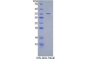 SDS-PAGE analysis of Mouse SUV420H2 Protein.