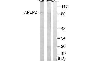 Western blot analysis of extracts from A549 cells and RAW264.