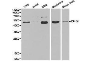 Western Blotting (WB) image for anti-Epoxide Hydrolase 1, Microsomal (Xenobiotic) (EPHX1) antibody (ABIN1872557) (EPHX1 Antikörper)