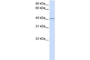 WB Suggested Anti-C2orf18 Antibody Titration:  0. (SLC35F6 Antikörper  (Middle Region))