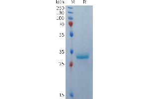 Human BCMA(1-22) Protein, mFc Tag on SDS-PAGE under reducing condition.