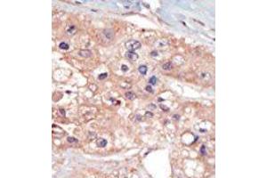 Image no. 2 for anti-U2AF Homology Motif (UHM) Kinase 1 (UHMK1) (N-Term) antibody (ABIN360529) (UHMK1 Antikörper  (N-Term))