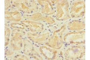 Immunohistochemistry of paraffin-embedded human kidney tissue using ABIN7170732 at dilution of 1:100 (STRADA Antikörper  (AA 25-210))