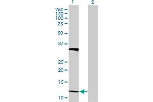 Western Blot analysis of FGF5 expression in transfected 293T cell line by FGF5 MaxPab polyclonal antibody. (FGF5 Antikörper  (AA 1-123))