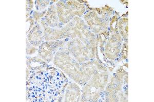 Immunohistochemistry of paraffin-embedded mouse kidney using MYLK antibody at dilution of 1:100 (x40 lens). (MYLK Antikörper)