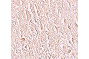 Immunohistochemical staining of human brain cells with LRRTM3 polyclonal antibody  at 2.