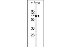 Western blot analysis in mouse lung tissue lysates (35ug/lane). (Glypican 3 Antikörper  (C-Term))