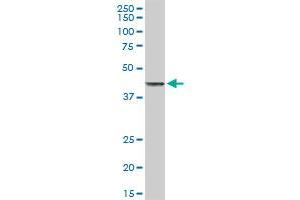 Western Blotting (WB) image for anti-Tumor Necrosis Factor Receptor Superfamily, Member 10b (TNFRSF10B) (AA 1-440) antibody (ABIN522238)