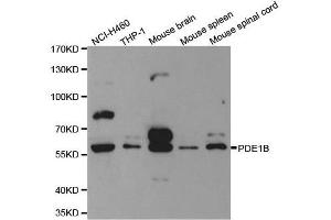 Western blot analysis of extracts of various cell lines, using PDE1B antibody. (PDE1B Antikörper  (AA 190-536))