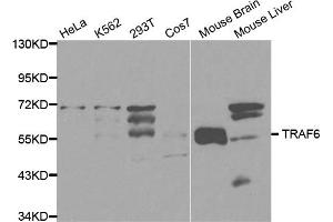 Western blot analysis of extracts of various cell lines, using TRAF6 antibody (ABIN5970361) at 1/1000 dilution. (TRAF6 Antikörper)